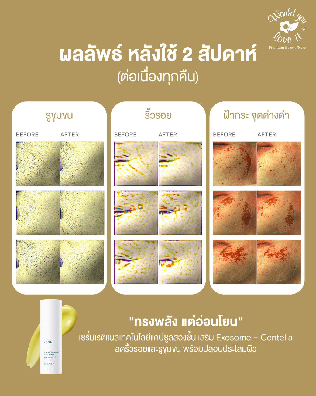/storage/gallery/product/228/venn-retinal-ผลลัพธ์-RICHMSG1.jpg