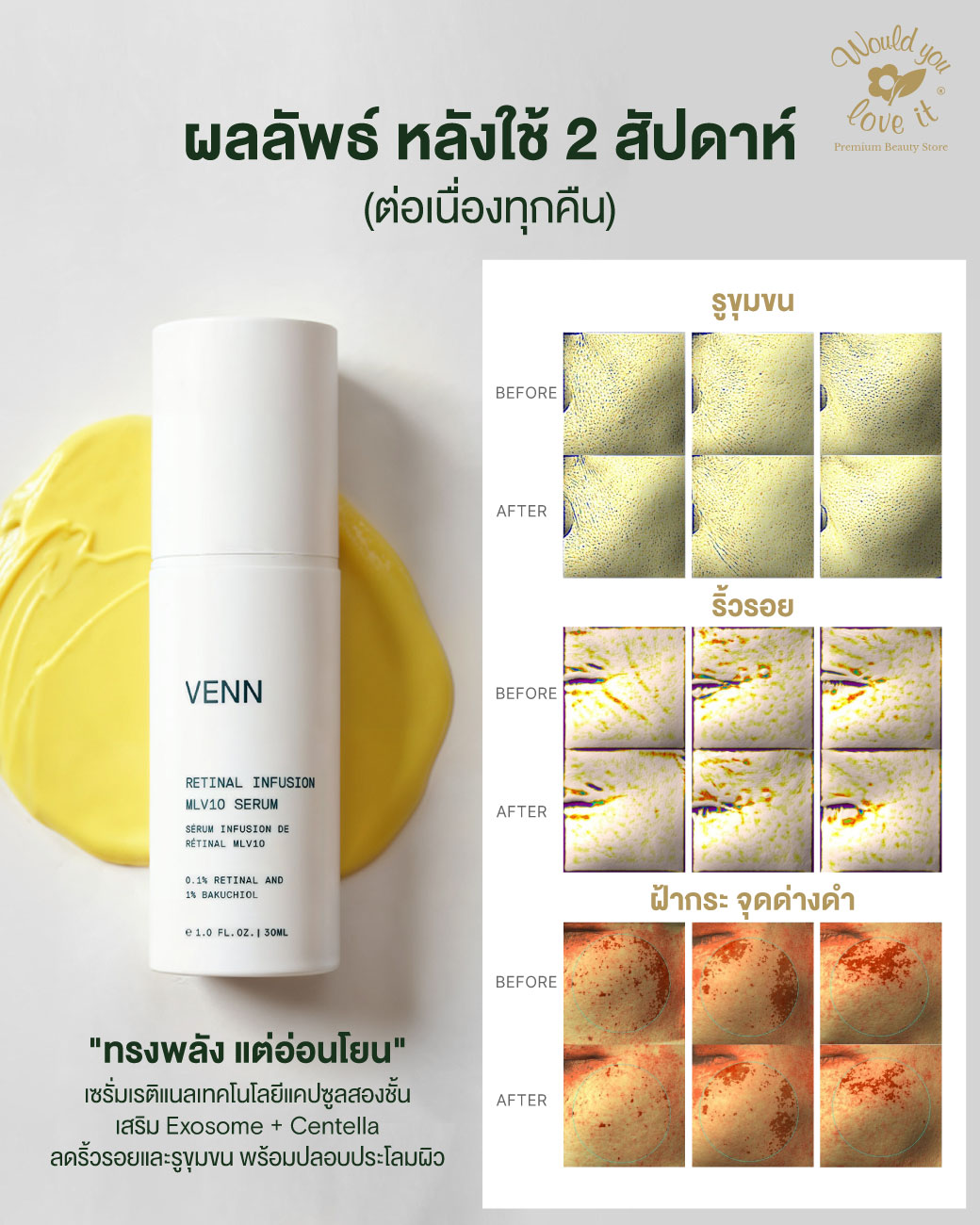 /storage/gallery/product/228/venn-retinal-ผลลัพธ์-RICHMSG2.jpg