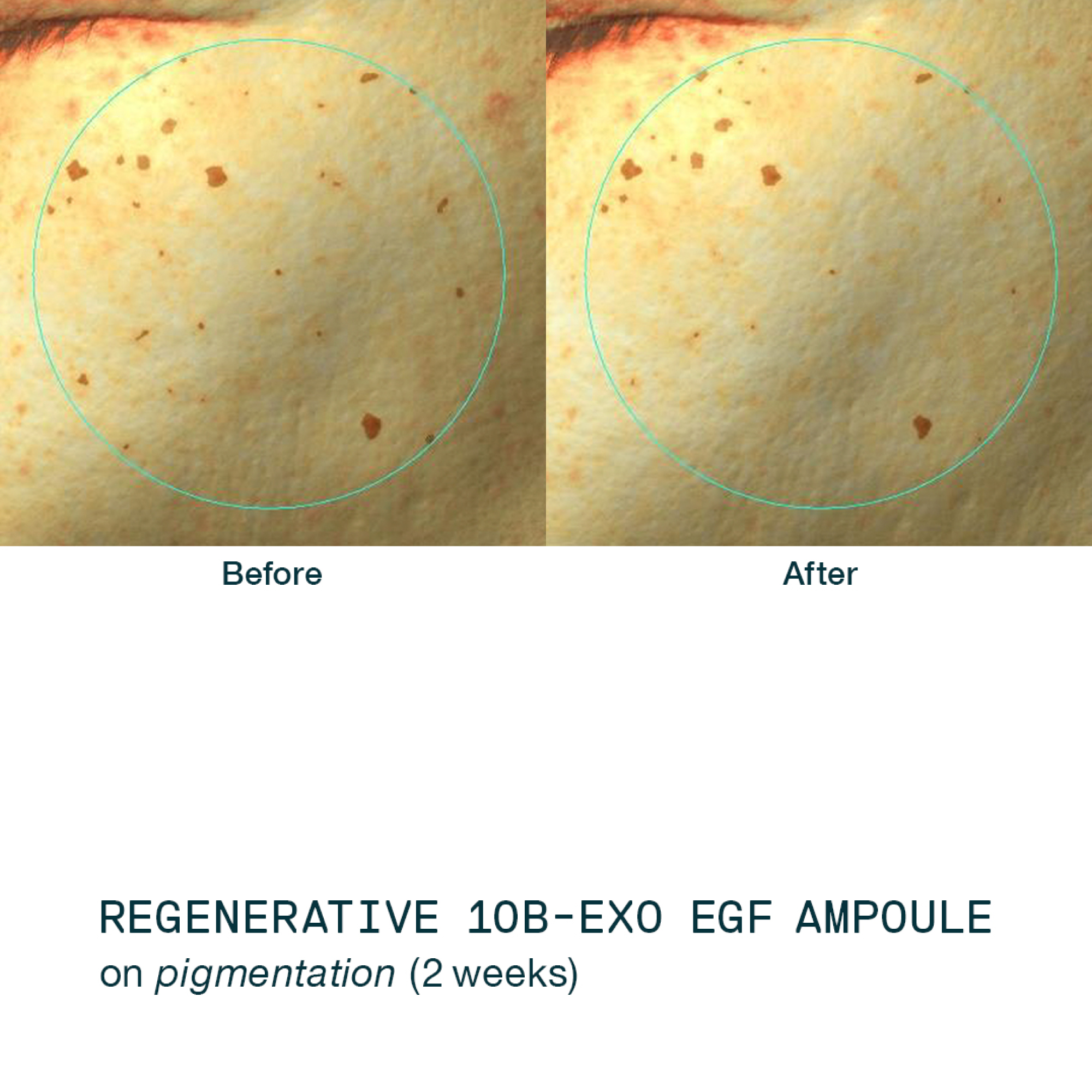 /storage/gallery/product/347/1.Regenerative-Serum-5.jpg