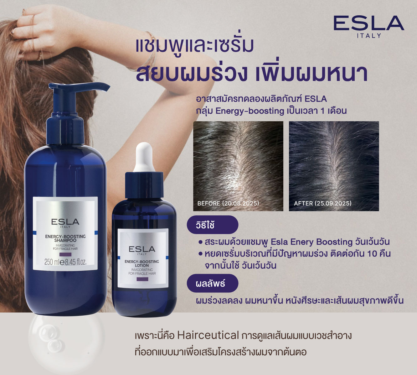 /storage/gallery/product/59/esla-ผมร่วงแบบไหนไม่ปกติ-review-LINECARD.jpg